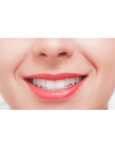 Dental Care, Teeth Whitening, Immediate Results, No Pain or Itching, No Need to Restrict Diet